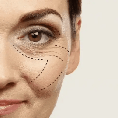✨ CELYN™ Instant Firm Eye – Dile Adiós a las Ojeras 2x1 ✨